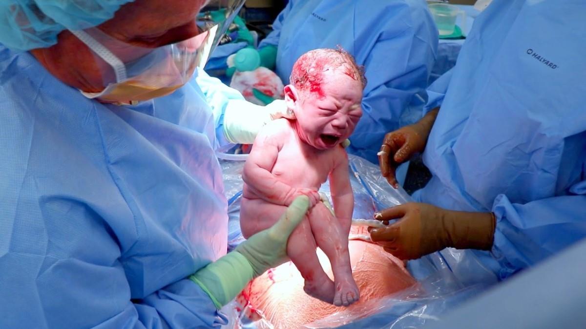 Ένα μικρό θαύμα: γεννήθηκε υγιέστατο αγοράκι από διασωληνωμένη μαμά με κορονοϊό